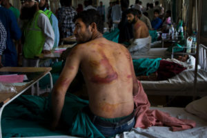 Kashmir group seeks UN probe into torture by India troops