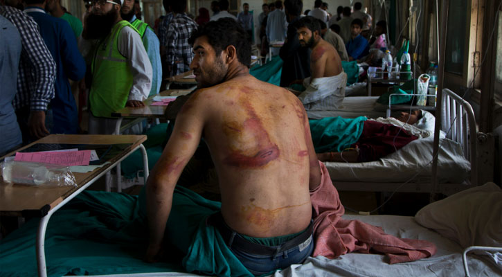 Kashmir group seeks UN probe into torture by India troops