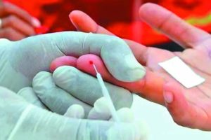 ‘AIDS deaths down a third since 2010’