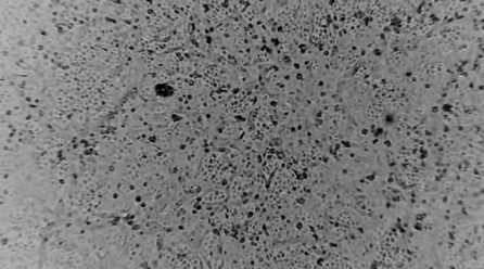 Australia ‘re-create’ coronavirus outside China