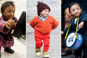 World’s shortest man Khagendra dies at 27