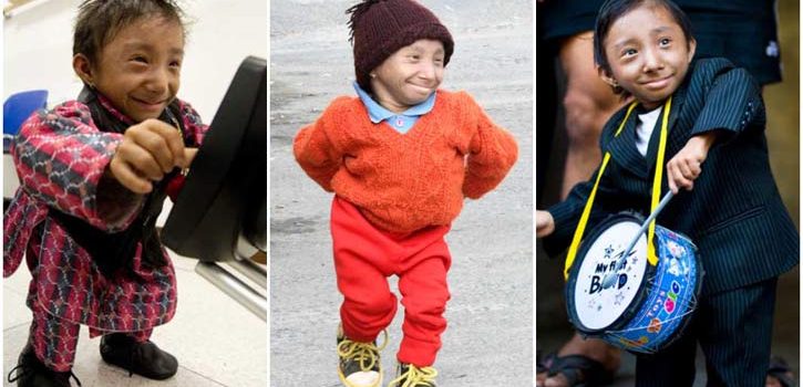 World’s shortest man Khagendra dies at 27