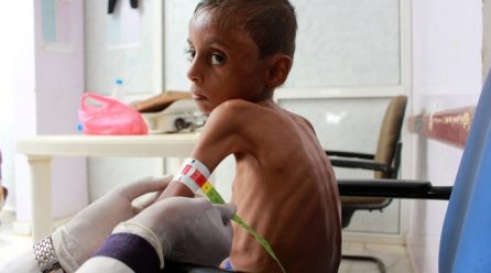 Yemen’s children starve amid rising fears of famine
