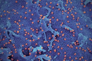 First Covid-19 reinfection documented in Hong Kong: Researchers