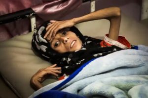 16 million Yemenis are marching towards starvation: UN