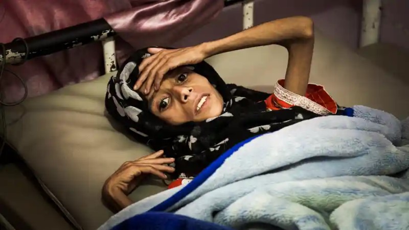 16 million Yemenis are marching towards starvation: UN