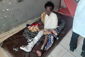 Ethiopia air strike killed 56: aid workers